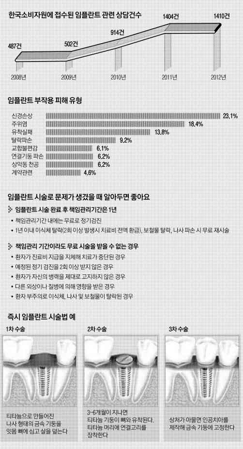 ‘편안한 임플란트’ 치과의사 실력이 좌우한다