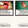 아이코스에도 발암 그림… 담뱃갑 흡연 경고 세진다