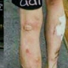 [종합] 팬조차 의아했던 박유천 다리 상처