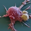 암세포만 정밀 타격하는 면역치료법 개발