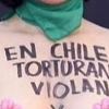 칠레 여가수, 라틴 그래미에서 상반신 누드 시위