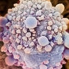 치료 어려운 대장암, 췌장암 유발 단백질 구조 밝혀냈다