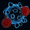 [과학계는 지금] 패혈증 일으키는 고장난 면역세포 발견