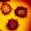 완치 후 항체 생겨도 ‘재감염’… 백신·치료제 개발 험난 비상