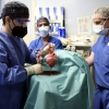 세계 첫 ‘돼지 심장’ 이식 후 사망 환자서 돼지 바이러스 발견