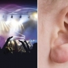 “귀 찢어졌어요” 강남 클럽서 귀 찢긴 만취 20대 여성