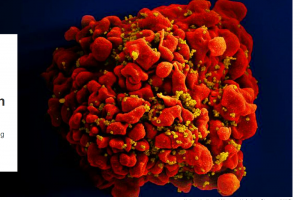 에이즈는 만성질환일 뿐?… “감염만 돼도 수명 5년까지 단축된다”
