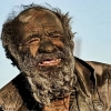 “물 닿으면 죽어” 67년 안씻고 버틴 男, 목욕 후 병 걸려 사망