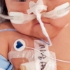 우연히 찍힌 소아중환자실 간호사의 ‘이 행동’…아기 엄마는 오열