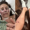 튜브 타다 수달 공격에… 귀 잘리고 얼굴·팔다리 피투성이 된 美여성