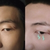 방탄소년단 RM 얼굴 다쳤다…눈썹 아래 깊은 상처