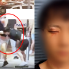 韓남성, 백인들에 ‘집단폭행’ 당해 응급실…바로 앞은 경찰서였다