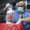 유전자 변형 ‘돼지 신장’ 이식받은 美 60대 환자, 두달 만에 숨져