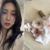 자이언트핑크, 피 묻은 휴지 사진 공개…“도와달라” 호소