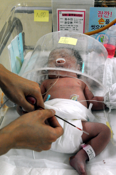 갓 태어난 아기가 산소치료를 위해 치료기 위에 누워있다. 이종원 선임기자 jongwon@seoul.co.kr
