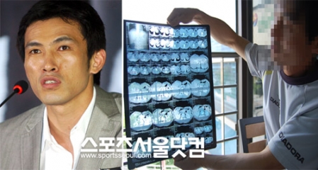 2004년 폭행 사건에 대해 서로 다른 주장을 펼친 유오성(왼쪽)과 피해자 강민선 씨