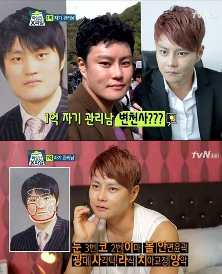 얼굴 부위 성형수술에 약 1억원을 투자한 배수광 씨.<br>tvN ‘화성인 X파일’ 캡처