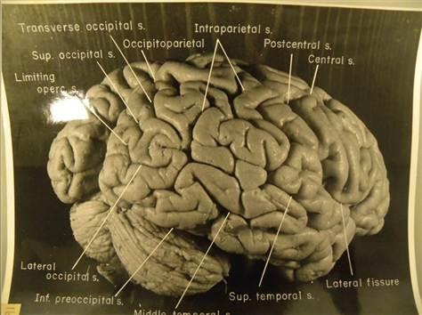 아인슈타인의 뇌 회백질에는 일반인보다 많은 주름이 잡혀 있는 것으로 밝혀졌다.  사진 제공=미국 보건의학박물관