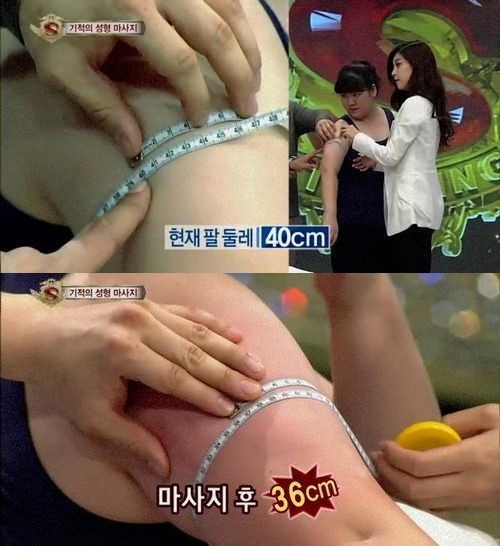 기적의 10분 마사지 종료 후 팔뚝 둘레가 4cm 줄어 36cm가 됐다. <br>SBS 방송화면