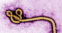 에볼라 바이러스