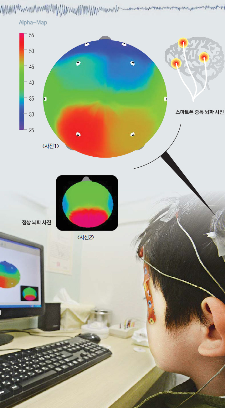 지난달 17일 서울 강남구 신사동에 있는 BR집중력의원에서 김재성(5세·가명)군이 머리에 전극을 붙이고 뇌파 측정 기계인 뉴로피드백 장비를 통해 뇌 기능 검사를 받고 있다.  박윤슬 기자 seul@seoul.co.kr