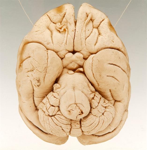 마카크 원숭이는 뇌의 12개 영역 중 11개가 사람과 일치하지만, 종합적이고 압축적인 정보를 다루는 영역이 없다. 사진은 영국 그랜트박물관에 전시된 마카크 원숭이의 뇌.  영국 런던대 제공 