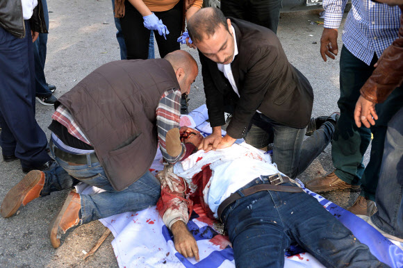 10일(현지시간) 터키 수도 앙카라 중앙역에서 폭탄 테러로 추정되는 폭발이 발생, 부상자를 시민들이 지혈하고 있다. 이날 폭발로 최소 30명이 사망했다. ⓒ AFPBBNews=News1