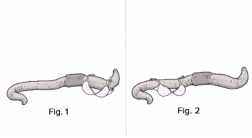 지렁이는 어떻게 브래지어를 착용해야 하나