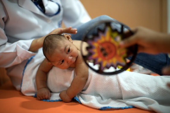 지카 바이러스에 감염된 산모에게서 태어난 생후 3개월 된 소두증 아이가 28일(현지시간) 브라질 헤시피의 한 병원에서 물리치료를 받고 있다. 헤시피 AP 연합뉴스