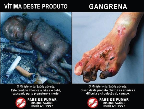 브라질의 흡연경고그림. 출처=담배업계 제공