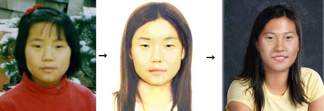1994년 4월 27일 실종된 서희영(1984년생)씨의 10세 때 사진.(왼쪽)  2009년 경찰청에서 당시 몽타주 기술로 만든 성인 모습.(가운데)  2010년 미국 실종아동찾기센터에 의뢰해 만든 성인 모습.(오른쪽)