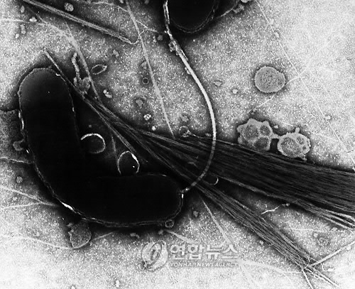 인간에게치명적인 설사병을 일으키는 전염병인 콜레라를 일으키는 콜레라 세균, 비브리오 콜레라의 전자현미경 사진