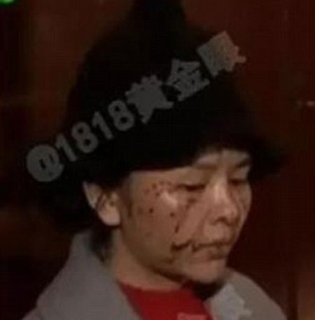 Zhajiang Television Station