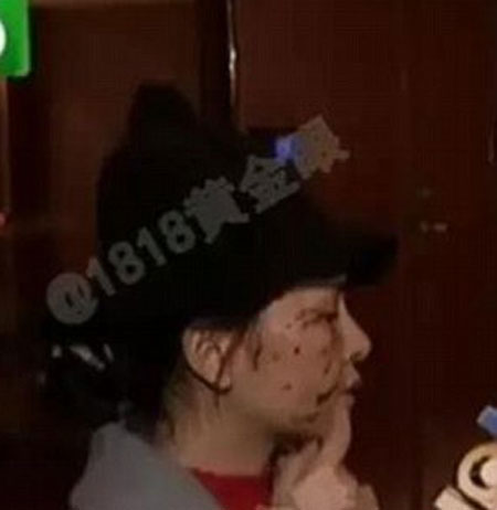 Zhajiang Television Station