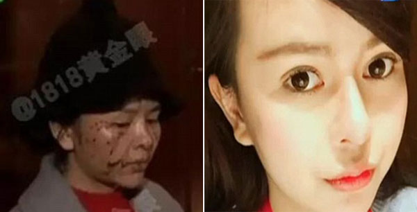 Zhajiang Television Station