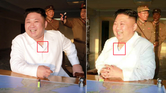 북한 김정은, 양쪽 가슴에 파스형 부착물 눈길