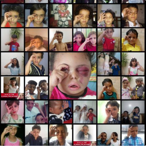 6살 부타이나 눈에 보인 전쟁… 예멘의 아픔 함께해요  