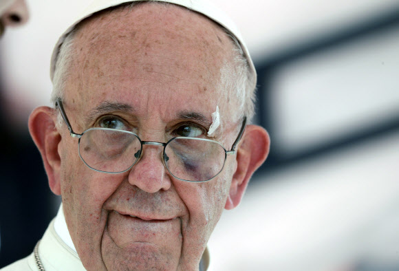 10일(현지시간) 콜롬비아를 방문한 프란치스코 교황이 작은 사고로 얼굴에 상처를 입고 얼굴에 연고를 바른 모습이 보인다. 안경 너머 왼쪽 눈밑에도 짙부른 멍자국이 보인다. AP연합뉴스