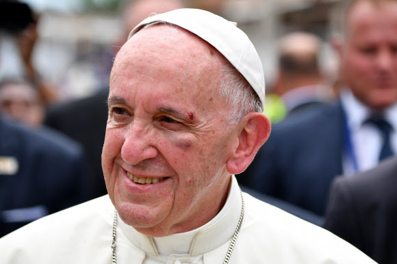 10일(현지시간) 콜롬비아를 방문한 프란치스코 교황이 작은 사고로 얼굴에 가벼운 상처를 입었다. AP 연합뉴스