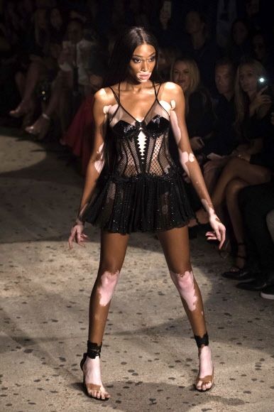 백반증 모델로 알려진 위니 할로우가 18일(현지시간) 영국 런던에서 열린 런던 패션위크 중 디자이너 줄리앙 맥도날드의 봄/여름 컬렉션 의상을 입고 런웨이를 걷고 있다. AP 연합뉴스