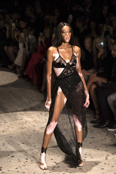 백반증 모델로 알려진 위니 할로우가 18일(현지시간) 영국 런던에서 열린 런던 패션위크 중 디자이너 줄리앙 맥도날드의 봄/여름 컬렉션 의상을 입고 런웨이를 걷고 있다. AP 연합뉴스