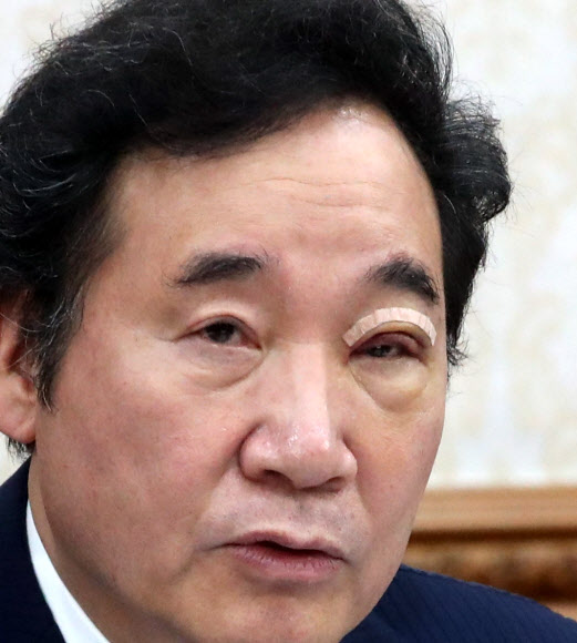 총리 눈에 무슨 일이?