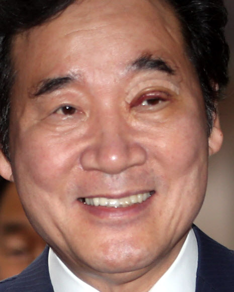 총리 눈에 무슨 일이?