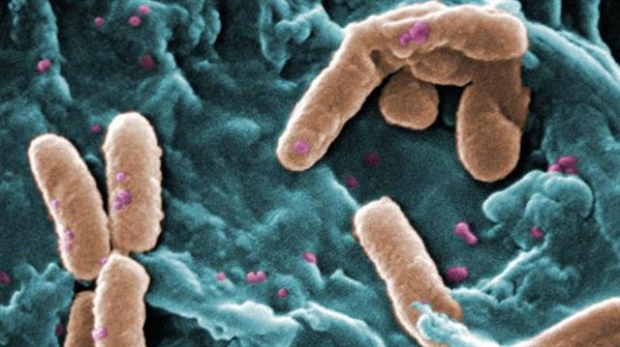 WHO가 ‘위급’단계에 포함시킨 녹농균.미국 질병관리예방센터(CDC) 제공