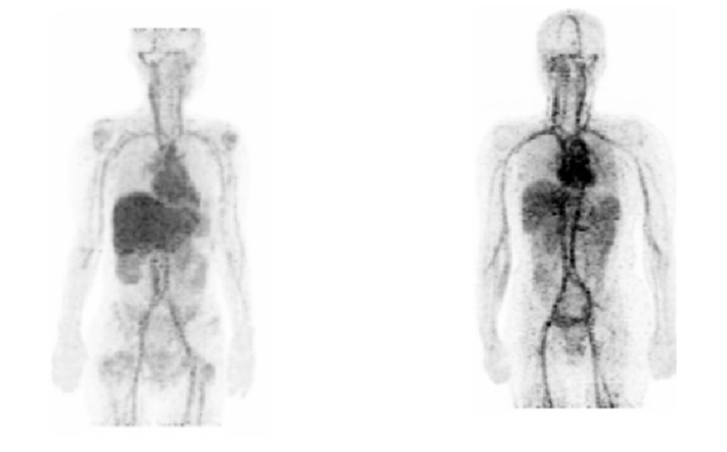 유방암 환자에게 방사성동위원소 구리-64를 주사해 유방암 발병과 치료효과를 정밀하게 영상으로 확인할 수 있는 기술을 개발했다. 한국원자력의학원 제공