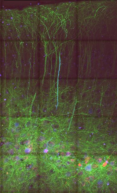 시냅스는 신경세포들을 연결해 신경신호를 전달하고 복잡한 신경망 회로를 만든다. 시냅스가 연결하는 신경세포들과 시냅스를 동시에 볼 수 있는 ‘mGRASP’ 기술을 이용해 자폐증과 지적장애를 유발시킨 생쥐의 전전두엽 피질을 찍은 이미지. 초록색으로 장식된 나무와 풀밭을 보는 듯한 느낌이다.  IBS 시냅스 뇌질환 연구단 제공