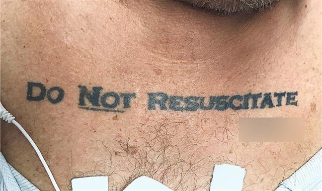한 남성의 가슴에 새겨진 ‘소생술 거부’ 문신. 디애틀랜틱 캡처