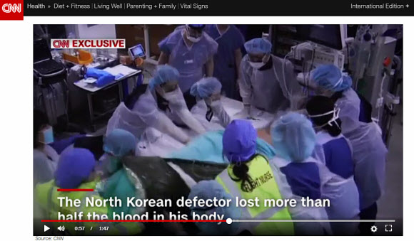 CNN, 북한 귀순 병사의 수술과정 보도