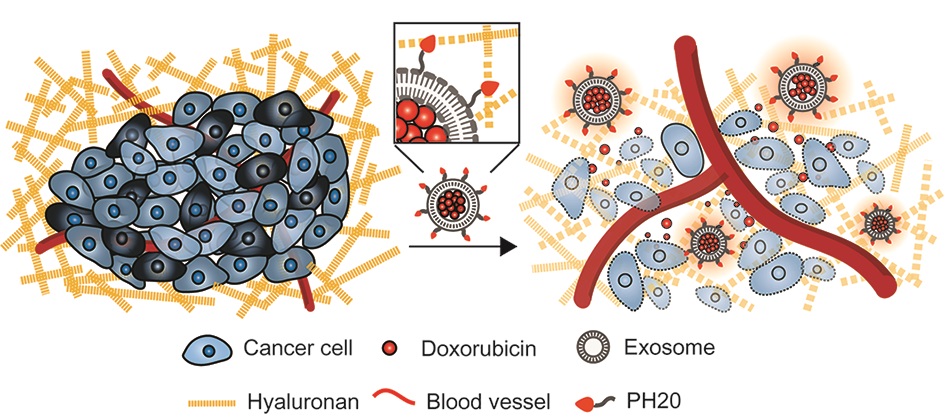 히알루로니다아제와 엑소좀을 결합시킨 ‘효소 엑소좀’이 암세포벽을 쉽게 녹여 종양의 확산을 줄일 수 있다는 사실을 확인했다. KIST 제공