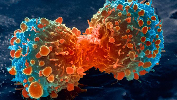 폐암세포의 증식 모식도 호주 국립암연구센터 제공